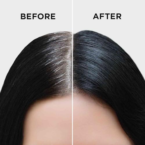 Orgatre Quick Gray Hair Touch Up Stick For Grey Hair 4.5Ml|Instant Gray Coverage|Semi Permanent|Black Color|Smudge-Proof & Long-Lasting|For All Hair Types|Enriched With Almond & Olive Oil,1 Count