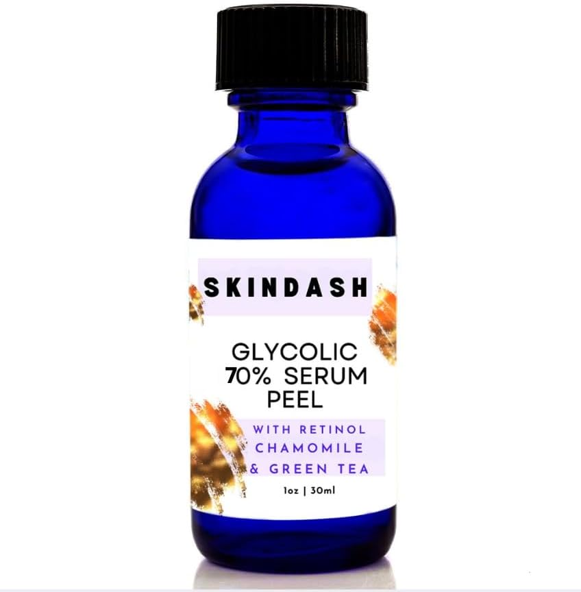 70% Glycolic Acid Serum Peel - with Retinol & Chamomile Green Tea ExtractS For Wrinkles, Acne Scars, Fine Lines, Collagen Boost – Anti -Aging Alpha Hydroxy Acid 1oz Bottle