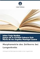 Morphometrie des Zellkerns bei Lungenkrebs (German Edition) 6208953480 Book Cover