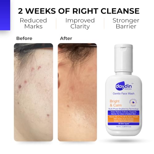 Image of Brightening Face Wash-Niacinamide, Kojic Acid, Vitamin C & NMF | Non-Irritant, For Tan Removal & Glowing Skin, Evens Skin Tone, Optimal pH for Men & Women, Oily & Combination Skin Types