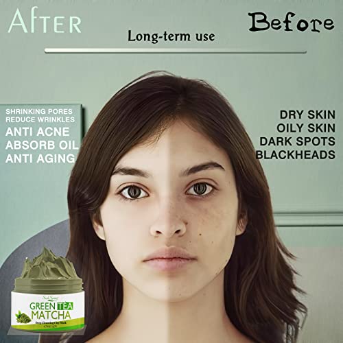 Seed Spring Vitamin C Clay Mask, Green Tea Matcha Facial Mud Mask With Deep Cleaning Relaxing 4.78Oz #TOP3