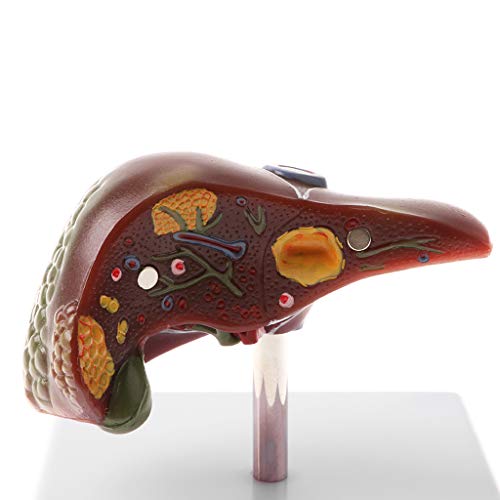 Human Diseased Liver Model, Lab Equipment