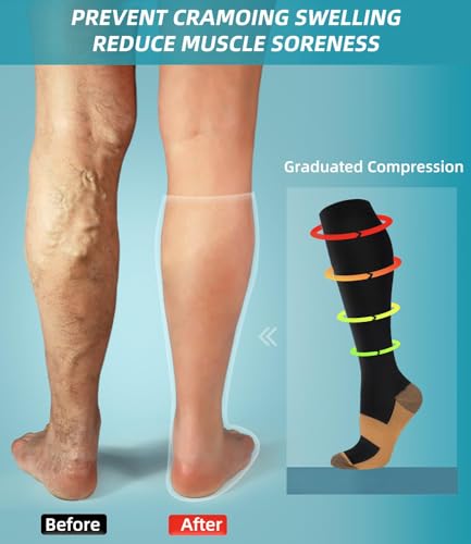 FuelMeFoot Compression Socks For Women Men - Graduated Support Knee High Socks For Nurses, Travel, Athletic3