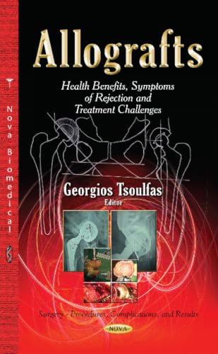 Allografts: Health Benefits, Symptoms of Rejection and Treatment Challenges (Surgery-procedures, Complications, and Results)