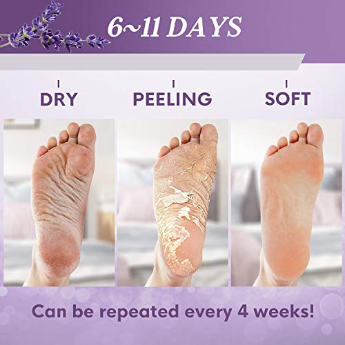 3 Pack Foot Peel Mask-Natural Exfoliation Foot Peel For Dry Dead Skin, Callus, Repair Rough Heels Lavender Foot Masks Make Your Feet Baby Soft #TOP3