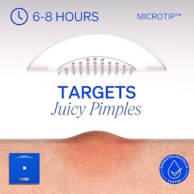 KNEMO RIGHT AWAY Microtip Hydrocolloid Acne Pimple Patch for Early Stage Zits and Hidden Blemish (8 Patches) Microdart Patch