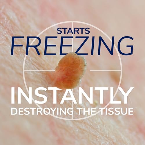 dr scholl39s freeze away skin tag remover kit 8 ct  completely removes skin tags in as little as 1 treatment fda-cleared amp clinically proven at-home removal easy 1-handed action permanent results