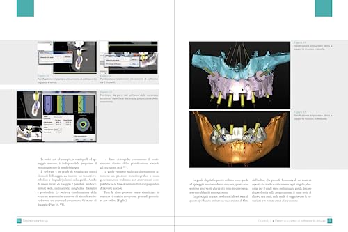 Digital Implantology - 5