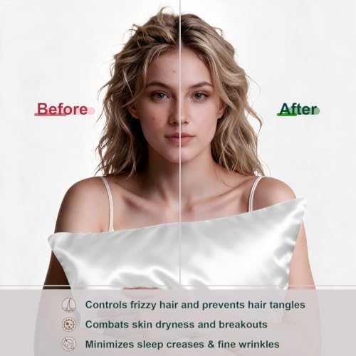 Image of LYSHIN White Silk Pillow Cases 2 Pack King Size with Zipper | 19 Momme Mulberry Silk Pillowcase for Skin and Hair, Anti-Acne, Hypoallergenic, Cooling, Beauty Sleep, Gifts for Women