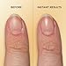 Sally Hansen Vitamin E Nail & Cuticle Treatment Pen | Hydrates and Conditions Dry Nails | Nourishing Formula with Apricot Oil | Smooth, Healthy-Looking Nails | Easy, Mess-Free Nail Care on the Go