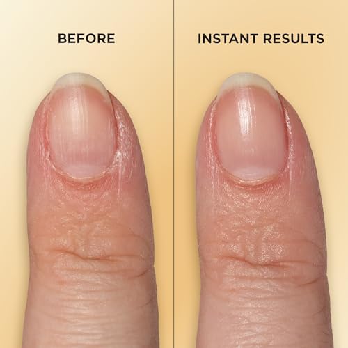 Sally Hansen Vitamin E Nail & Cuticle Treatment Pen | Hydrates and Conditions Dry Nails | Nourishing Formula with Apricot Oil | Smooth, Healthy-Looking Nails | Easy, Mess-Free Nail Care on the Go - Image 6