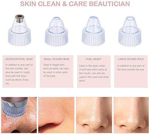 Bella Faccia Cordless Multifunction Acne Pimple Pore Cleaning Blackhead Whitehead Extractor/Remover/Vacuum Action Device with 4 Interchangeable Suction Head fo Women - Image 5