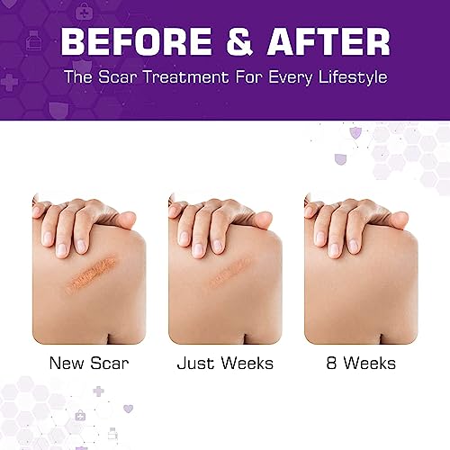 Silicone Scar Sheets(1.6' x 60'Roll-1.5M) Soft Silicone Gel Scar Tape Painless Silicone Tape Roll - Reusable, Medical Grade Silicone Scar Removal Strips for C-Section & Keloid Surgery, Burn, Acne