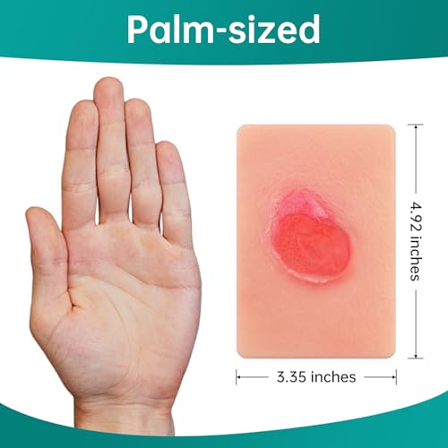 Image of Pressure Ulcer Wound Model Stage 2 Pocket Size, Pressure Injury Wound Packing Trainer for Medical Education, Decubitus Ulcer Wound Care Demonstrations Tool