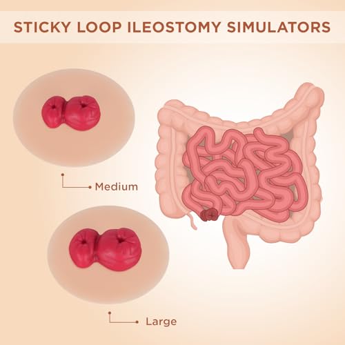 Image of Sticky Loop Ileostomy Simulators, Double-Barrel Stoma Training Model Set, Multi-Skin Tone Ostomy Care Practice Models for Medical Training and Patient Education - Light