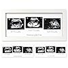 Sonogram Picture Frame – Trio Ultrasound Picture Frames For Mom To Be Gift – Baby Ultrasound frame – Pregnancy…