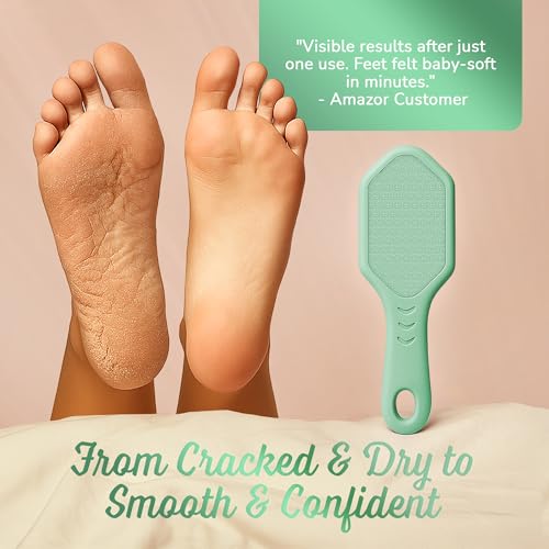 Silicone Foot Callus Remover - Nano Glass Foot File for Dead Skin and Cracked Heels - Callus Remover for Feet & Hard Skin - Ergonomic Foot Scrubber & Exfoliator for Soft, Smooth Feet - Green