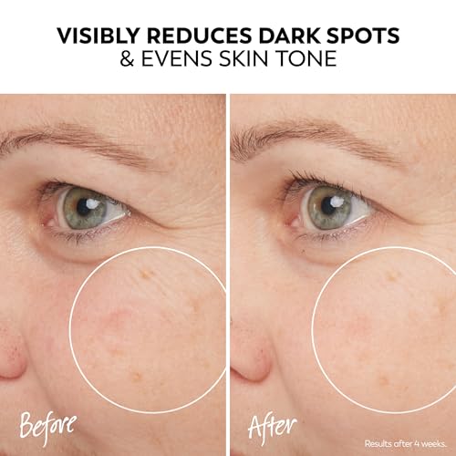 Olay Pro-X Dermatological Even Skin Tone Spot Fading Treatment Serum, 1.3 oz - image 4