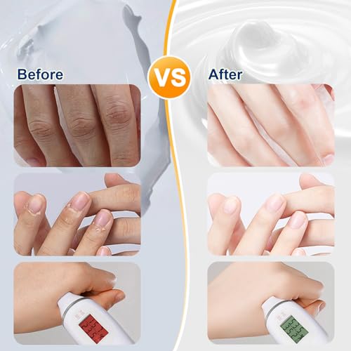 OFUN 20 Pack Hand Cream Gift Set for Women Dry Cracked Hand Care Moisturizing Lotion Christmas Mother's Day Valentine's 