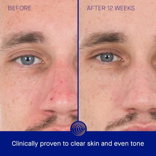 Augustinus Bader The Retinol Serum, view 3