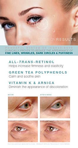 Under Eye Repair Cream - All-Trans-Retinol Under Eye Revive Anti Aging Eye Cream For Dark Circles And Puffiness, Under Eye Bags, Fine Lines, Wrinkles - 0.5 Oz #TOP4