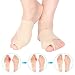 Produktbild Hallux Valgus Bandage Hallux Valgus Socken Hallux Valgus Korrektur Schiene Bunion Corrector Sleeve Ballenschutz Mit Eingebaut Silizium Groß Zehenspreizer und Fersengürtel for Schmerzlinderung-1 Paar