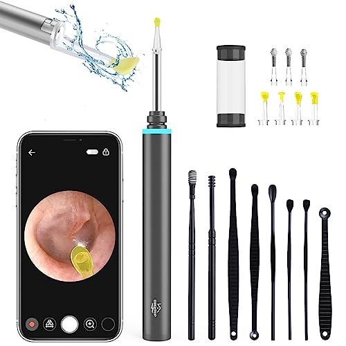 3.9Mm Hd Ear Cleaner With Camera And Light,Smart Visual Ear Endoscope With Ear Wax Removal Tools And 6 Adjustable Led Lights Compatible Ear Cleaner For Iphone, Ipad, And Android,Black #TOP23