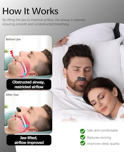 Anti Snoring Devices, Electric Snoring Solution with Adjustable Strap, Universal Fit for All Nose Shapes, Adjustable 6-Speed, Mini Portable Sleep Apnea Devices for Men (Matte Black)