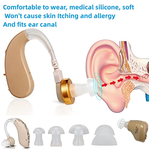 100 Packs Universal Hearing Aid Domes - 4 Sizes X 25 Pack For Each: Small, Medium, Large & X-Large Earbud Replacements And Bte Hearing Sound Amplifiers Universal Domes #TOP3