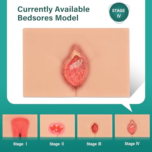 Image of Decubitus Ulcer Care Model, Bedsores Model