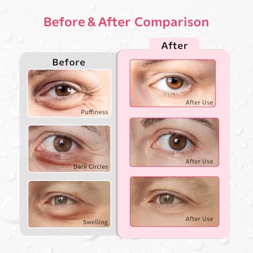 Image of 4PCS Gel Eye Ice Pack Set, Cold & Hot Compress, Reusable Cooling Gel Pads for Strain Relief, Relaxation, SPA and Sleep (4 Strawberries)