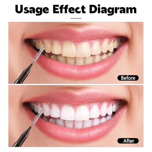 Image of 100 Pcs Interdental Brushes, Braces Flossers for Cleaner | Braces Brush Soft Dental Brushe Toothpicks Dental Floss Picks Dental for Brace Oral Cleaning(2 Colors)