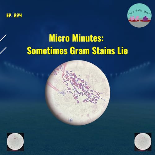 224: Micro Minutes: Sometimes Gram Stains Lie