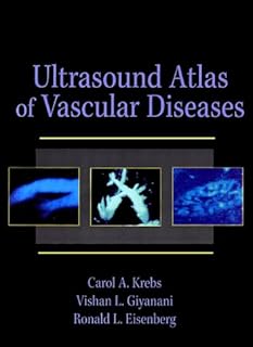 Ultrasound Atlas of Vascular Diseases