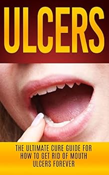 Paperback Ulcers: The Ultimate Cure Guide for How to Get Rid of Mouth Ulcers Instantly Book