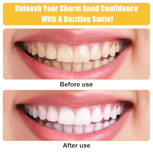 Image of 4 Rolls Tooth File 4mm x 6m, Dental Polishing Strips, Tooth Polisher Tools in Between Teeth Stain Remover, Teeth Polishing Kit, Dental Tape Sanding Strips for Teeth Polish