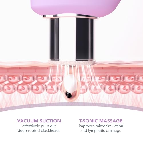 FOREO KIWI Derma Microdermabrasion Machine, Whitehead & Blackhead Remover Tool - Image 3