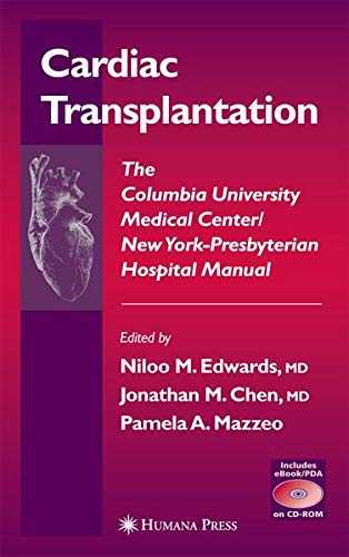 Buy Cardiac Transplantation: The Columbia University Medical Center/New York-Presbyterian Manual — BookShops.in