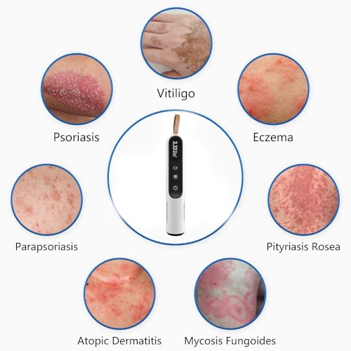 Image of UVThera 308nm LED UVB Pen- Handheld Targeted Light Therapy Device for Vitiligo & Psoriasis | Compact Home Use UVB Device with LCD Timer