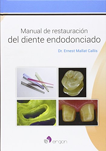 Manual de restauración del diente endodonciado Manual de restauración del diente endodonciado