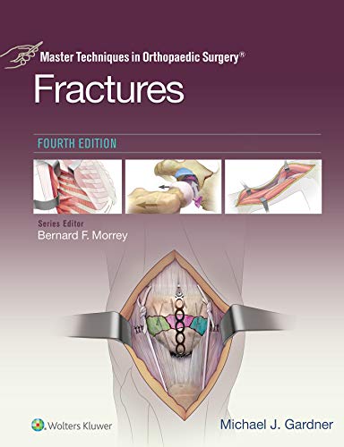 Master Techniques in Orthopaedic Surgery: Fractures Master Techniques in Orthopaedic Surgery: Fractures