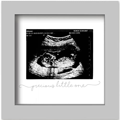 KeaBabies Baby Sonogram Picture Frame - Modern Ultrasound Frame for Mom to Be - Pregnancy Announcement Sonogram Photo Frames - Gender Reveal for Expecting Parents - First Time Dad Gifts (Cloud Gray)
