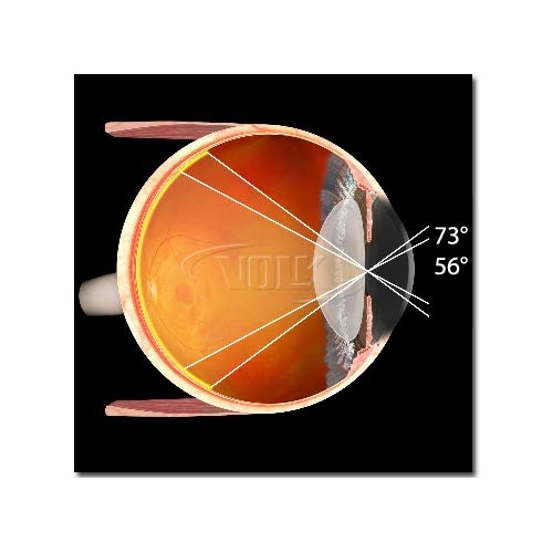 Volk Pan Retinal 2.2 Classic Bio Lenses- Silver #TOP2