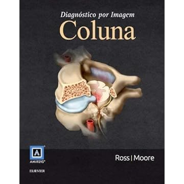 Capa do livro Diagnóstico por imagem - Coluna