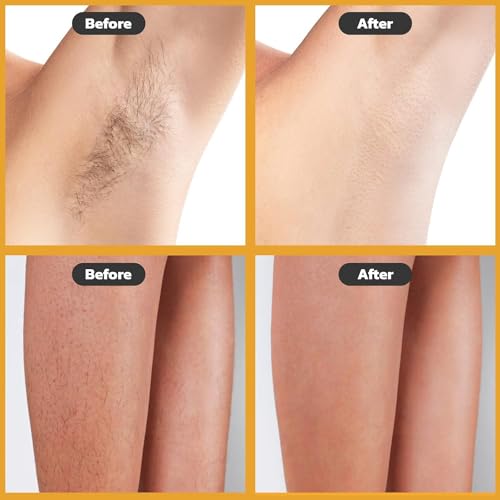 Image of Hair Removal Wax Kit Wax Heater Machine Roll on Hair Removal Wax Kit Wax Heater machine,Refill Cartridge Strips With Wipes Waxing kit for Women Waxkit (wax Roller Heater Machine Combo)