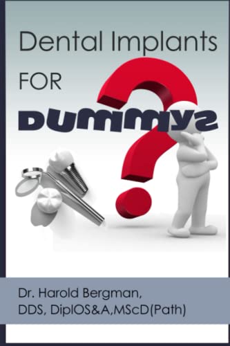 Dental Implants for Dummys