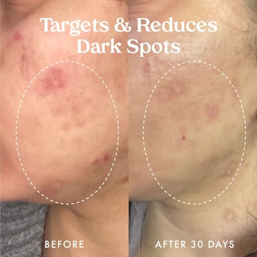 Kopari Star Bright Vitamin C Discoloration Correcting Serum with Kakadu Plum & Niacinamide, Brighter Complexion, Soothe & Diminish Dull Skin, 1.7oz - Thumbnail 5