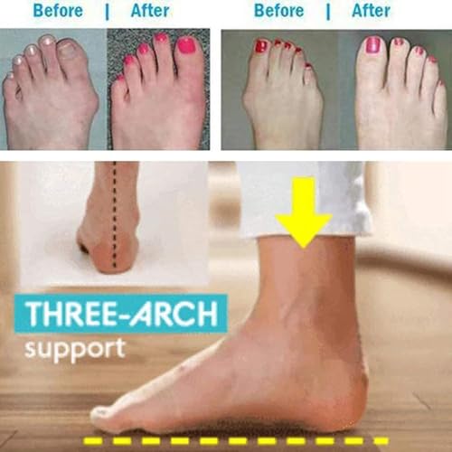 Ladies Summer Plantar Fasciitis Slippers,Comfy Foot Correction Womens Sandals For Hallux Valgus,Beach Flat Flip Flops With Arch Support2