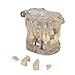 Transparent Dental Implant Disease Teeth Model Dentist Standard Pathological Removable Tooth Teaching Model Tools