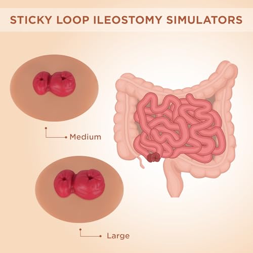 Image of Sticky Loop Ileostomy Simulators, Double-Barrel Stoma Training Model Set, Multi-Skin Tone Ostomy Care Practice Models for Medical Training and Patient Education - Tan